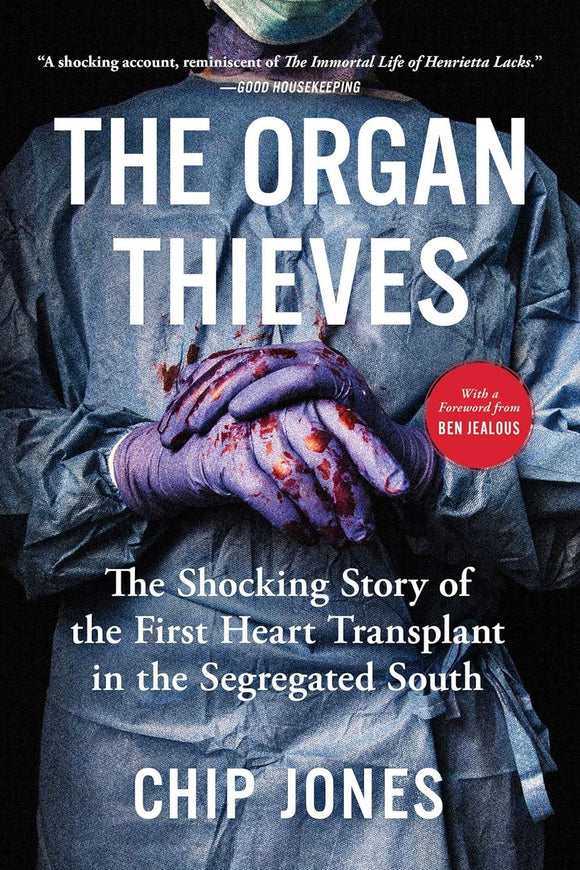 The Organ Thieves: The Shocking Story of the First Heart Transplant in the Segregated South by Chip Jones